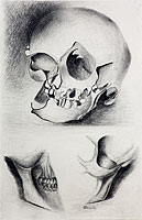 Xray